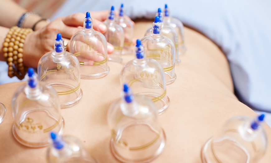 Image 1: Up to 51% Off on Cupping at Clinic Plus