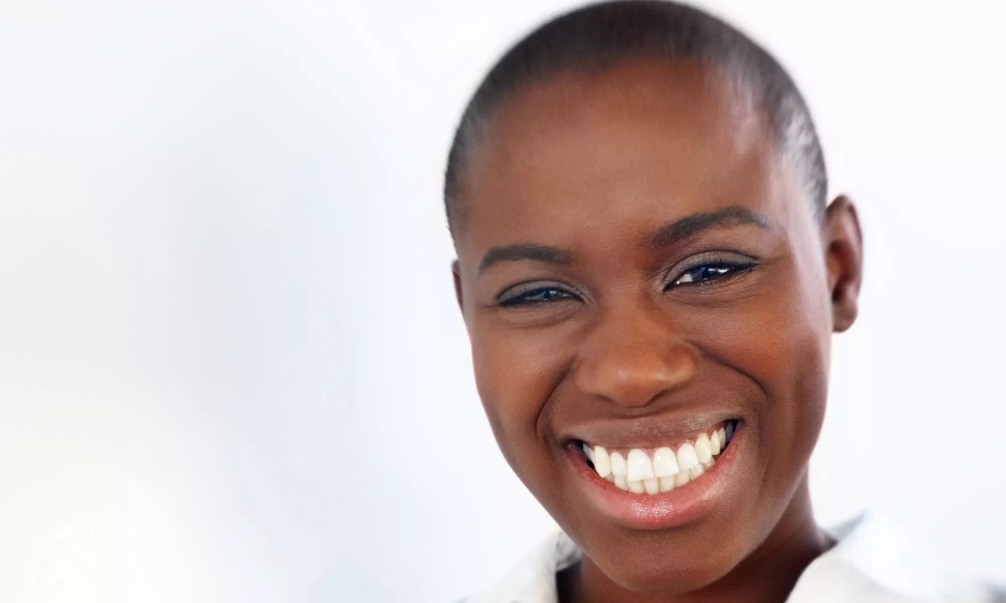 $99 for One 60-Minute Microneedling Treatment  at Regenevéda ($250 Value) - Primary Image