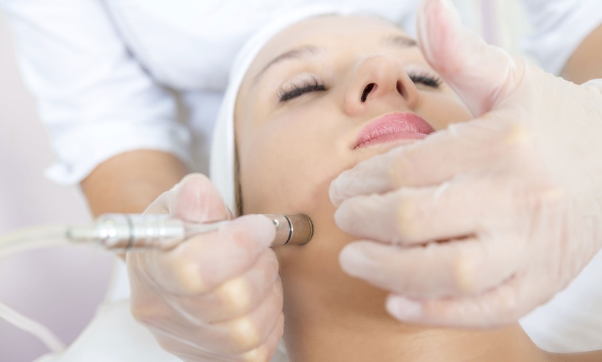 Image 1: Hydrodermabrasion exfoliation at Oxygen Artisan Skin & Body Lab