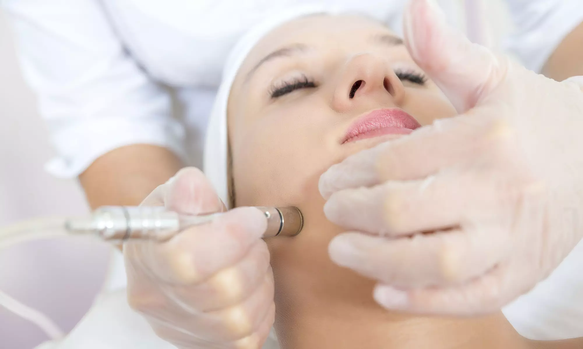 Microdermabrasion Treatment with Optional Add-Ons at Aesthetic Rejuvenation Center (Up to 63% Off) - Primary Image