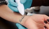 Get your tattoos removed with laser sessions for various sizes at East Hill Laser & Aesthetics, up to 80% off