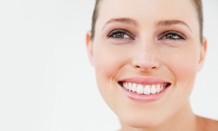 $1000 Towards Dental Implants, Crowns, or Vaneers - Design Dental Spa