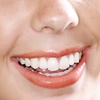 Image 1: Up to 70% Off on Dental Checkup at Apollo Dental