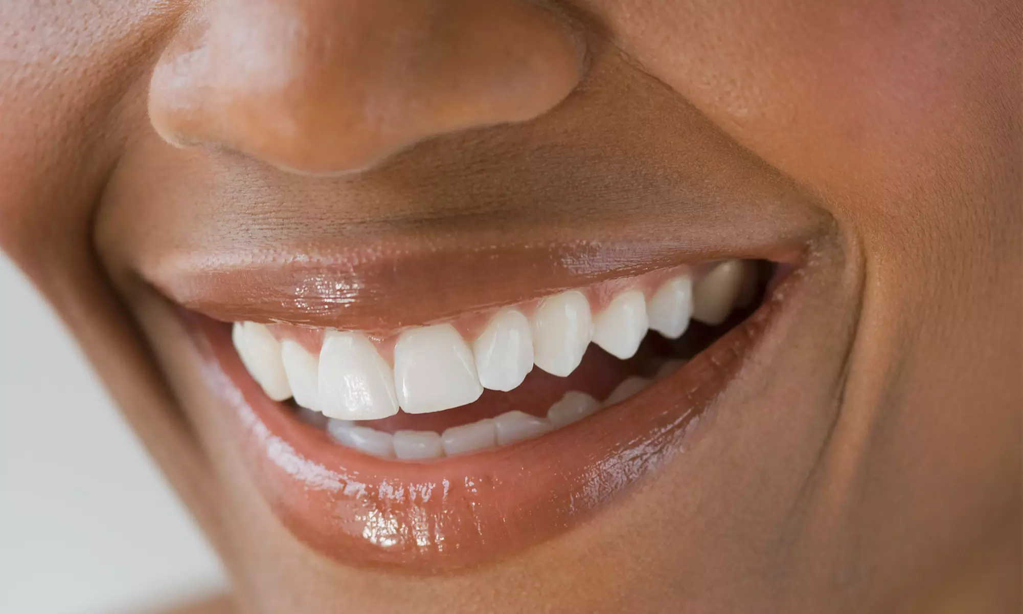 Dental Exam Cleaning Package at Community Smiles Dental Center (Up to 86% Off) - Primary Image