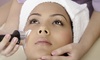 Discover Innovative Med Spa River North & Lincoln Park's 1 or 2 IPL Photofacials, up to 76% off