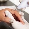 Image 5: 3 Sessions of Laser Pigment/Tattoo Removal (Up to 82% Off)