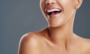 Limpieza bucal y blanqueamiento Limpieza bucal y blanqueamiento