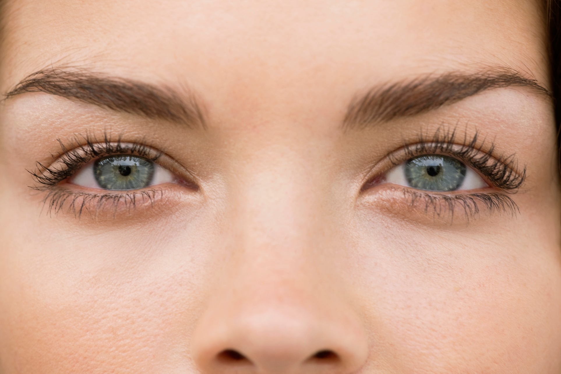 Enhance Your Look with Upper Eyelid Blepharoplasty