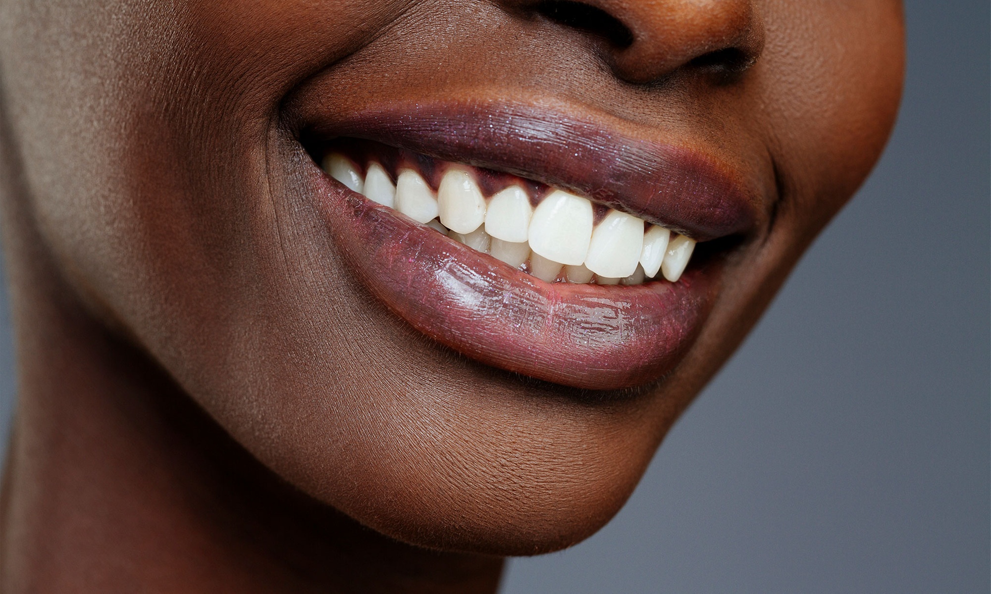 Up to 38% Off on Teeth Whitening - Salon at TruIdentity Spa Boutique