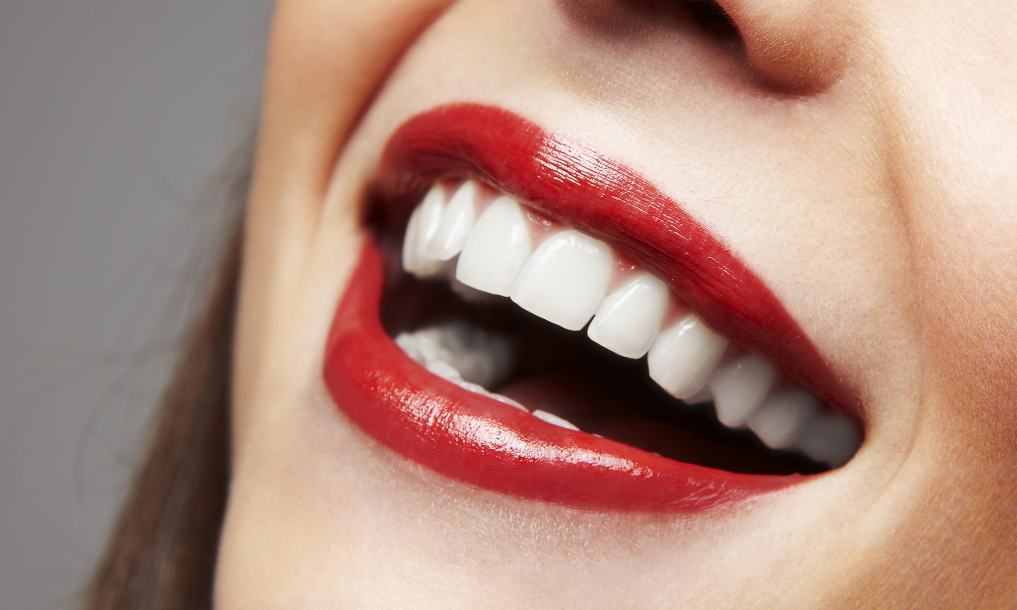 Limpieza bucal y blanqueamiento