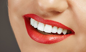 Limpieza dental y férula de descarga hasta -80% Limpieza dental y férula de descarga hasta -80%