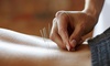 $74.50 for One Acupuncture Treatment with Pro Stretch at Acupuncture Center of South Florida ($175 Value)