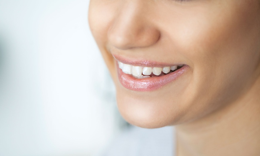 Image 1: Zoom Teeth Whitening at The Esplanade Dental Center