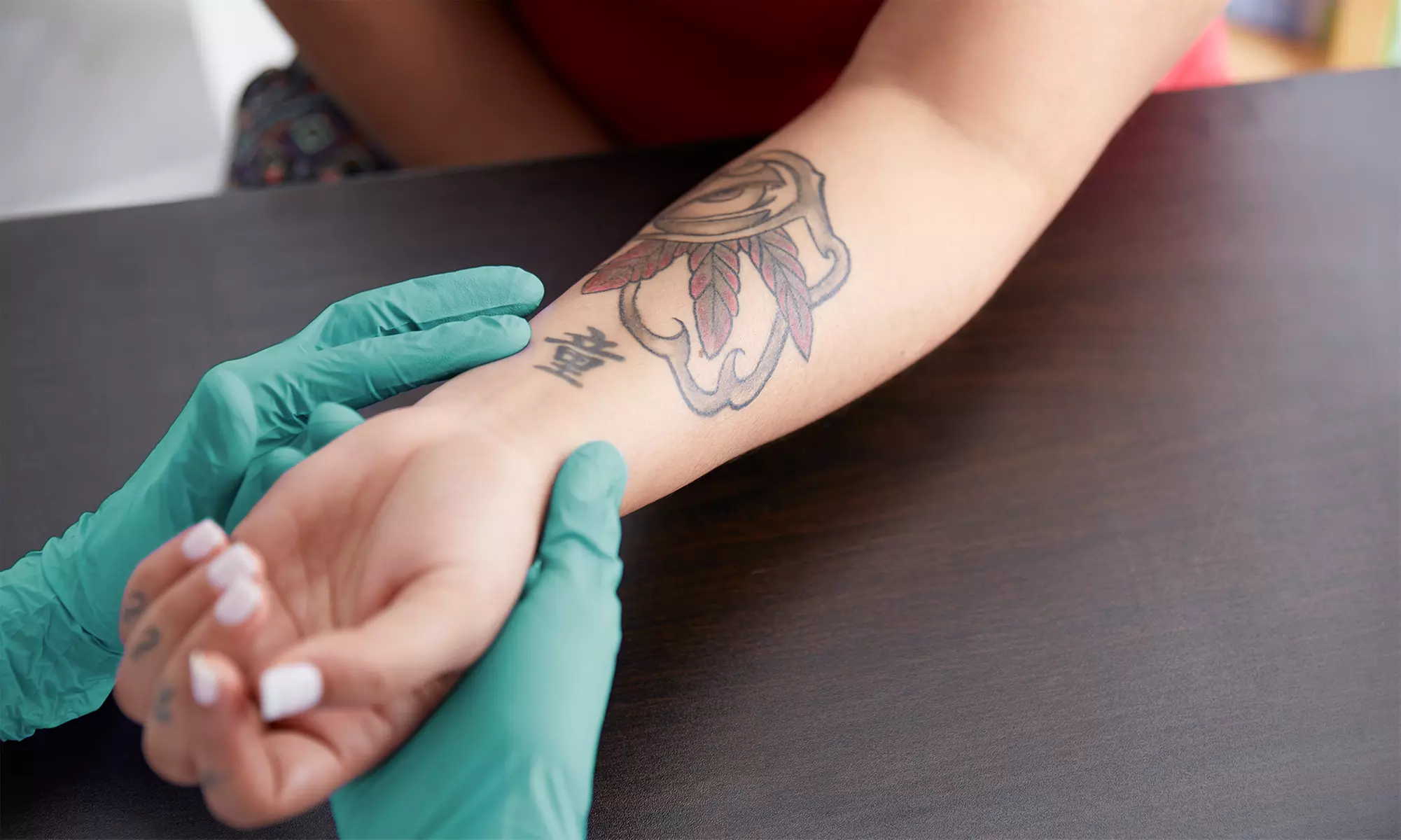One Tattoo-Removal Session on a Small, Medium, or Large Area at The Skin Station (Up to 34% Off) - Primary Image