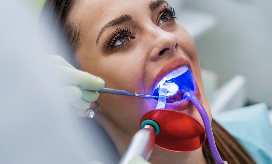 Image 1: Up to 20% Off on Teeth Whitening 