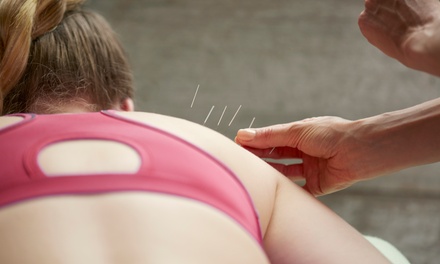 Three Acupuncture Treatments with Consultation; Valid with Kimberly Griffin -  D’Arcy Wellness Center and Spa