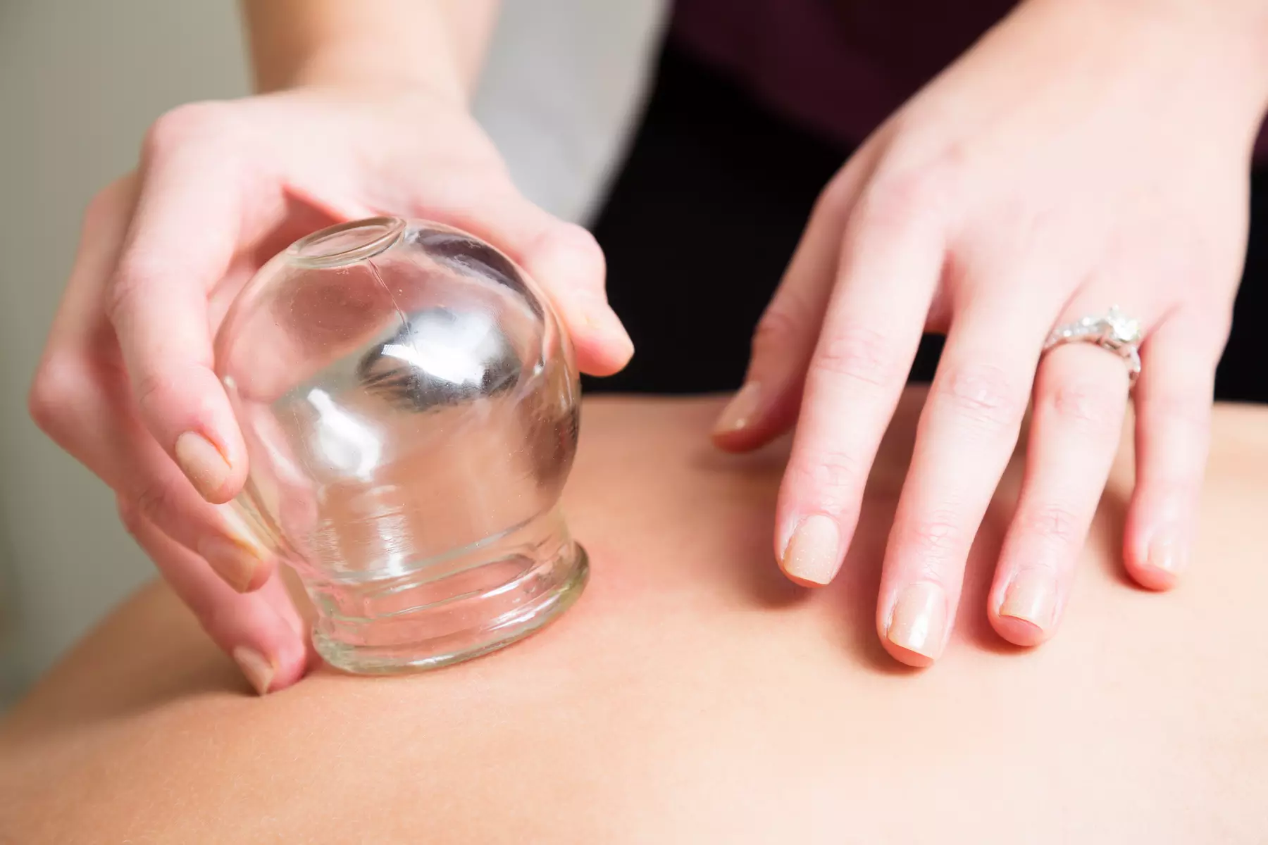 Up to 51% Off on Cupping at cryofloat360 - Primary Image