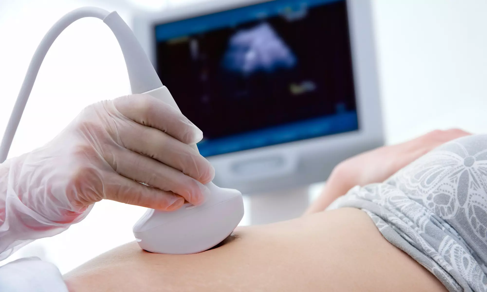 15-Minute 2D or 30-Minute Meet Your Baby 3D/4D Ultrasound with Up To 5 Black and White Images (Up to 50% Off) - Primary Image