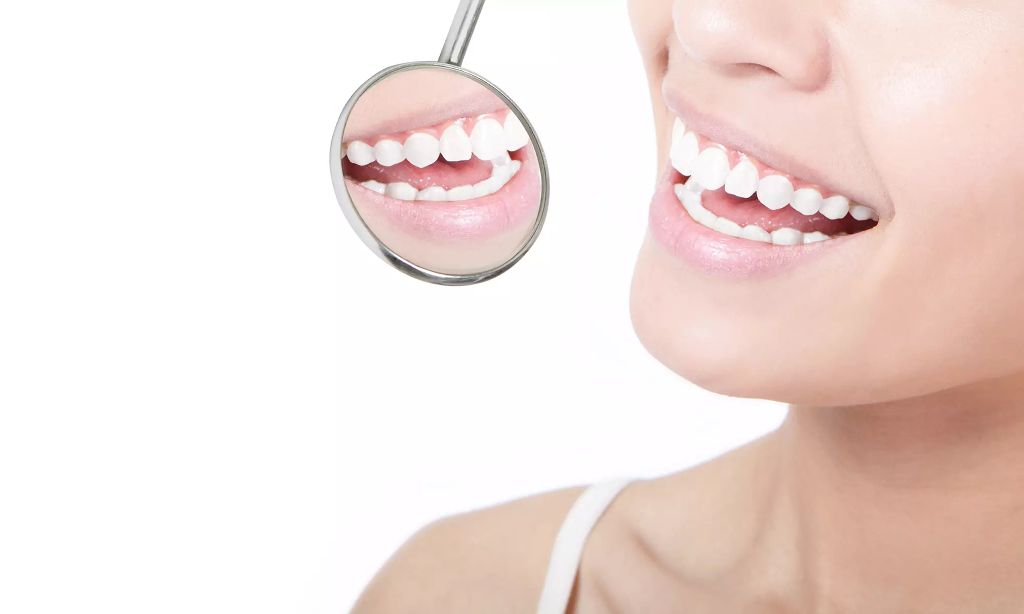 Presume de sonrisa: limpieza bucal con diagnóstico, revisión y opción a blanqueamiento con luz led para 1 persona - Primary Image