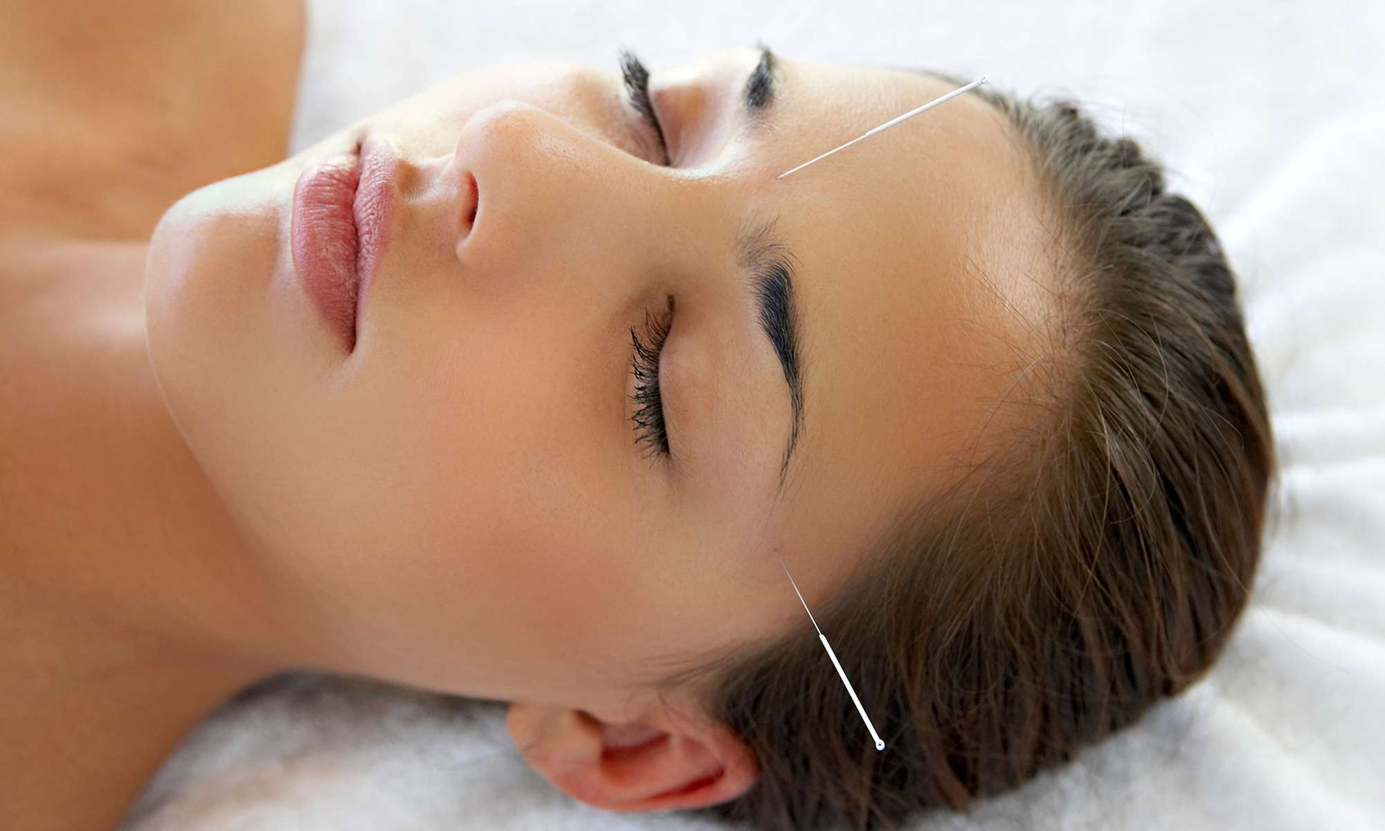 1 or 2 Acupuncture Sessions w/ Optional Cranial Sacral Therapy & More