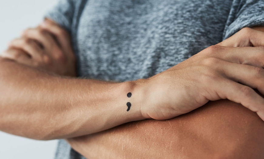 Image 1: Laser Tattoo Removal