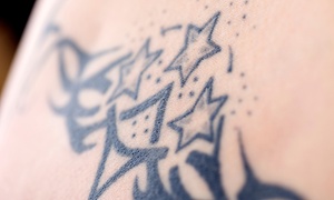 Rewind Tattoo: Rimozione tatuaggio nero o a colori fino a 10 x 10 cm allo studio Rewind Tattoo (sconto fino a 68%)