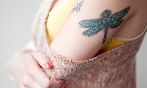 BodyTLC: Laser Tattoo Removal: One or Three Sessions for a Small Area by BodyTLC (Up to 57% Off)