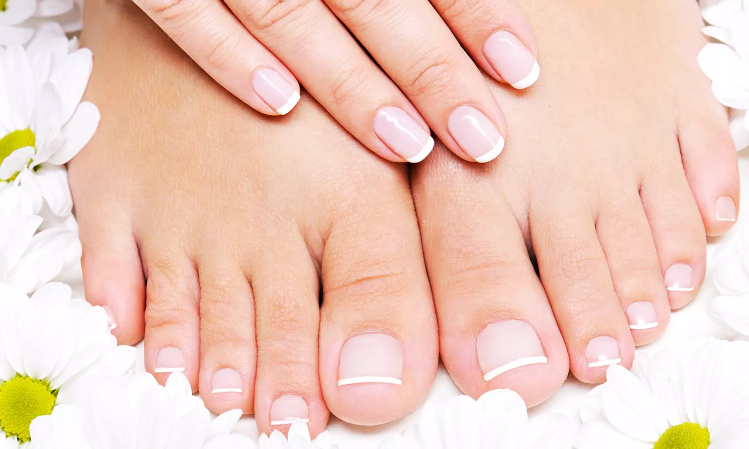 Laser Toenail-Fungus Removal for 1, 5, or 10 Toes at Dr. Michael Uro Foot Care (Up to 79% Off) - Primary Image