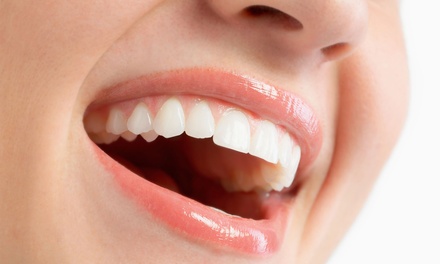 One Person: Dental Exam, Scale and Clean - Optimum Smile Dental Clinic