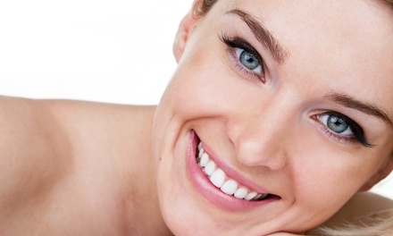 One Laser Facial/Laser Tightening and Rejuvenation for Full Face - New You Laser