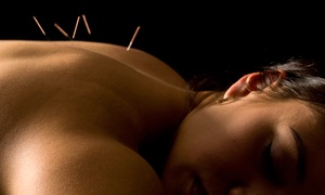 Experience 60-Minute Acupuncture Sessions for Holistic Health