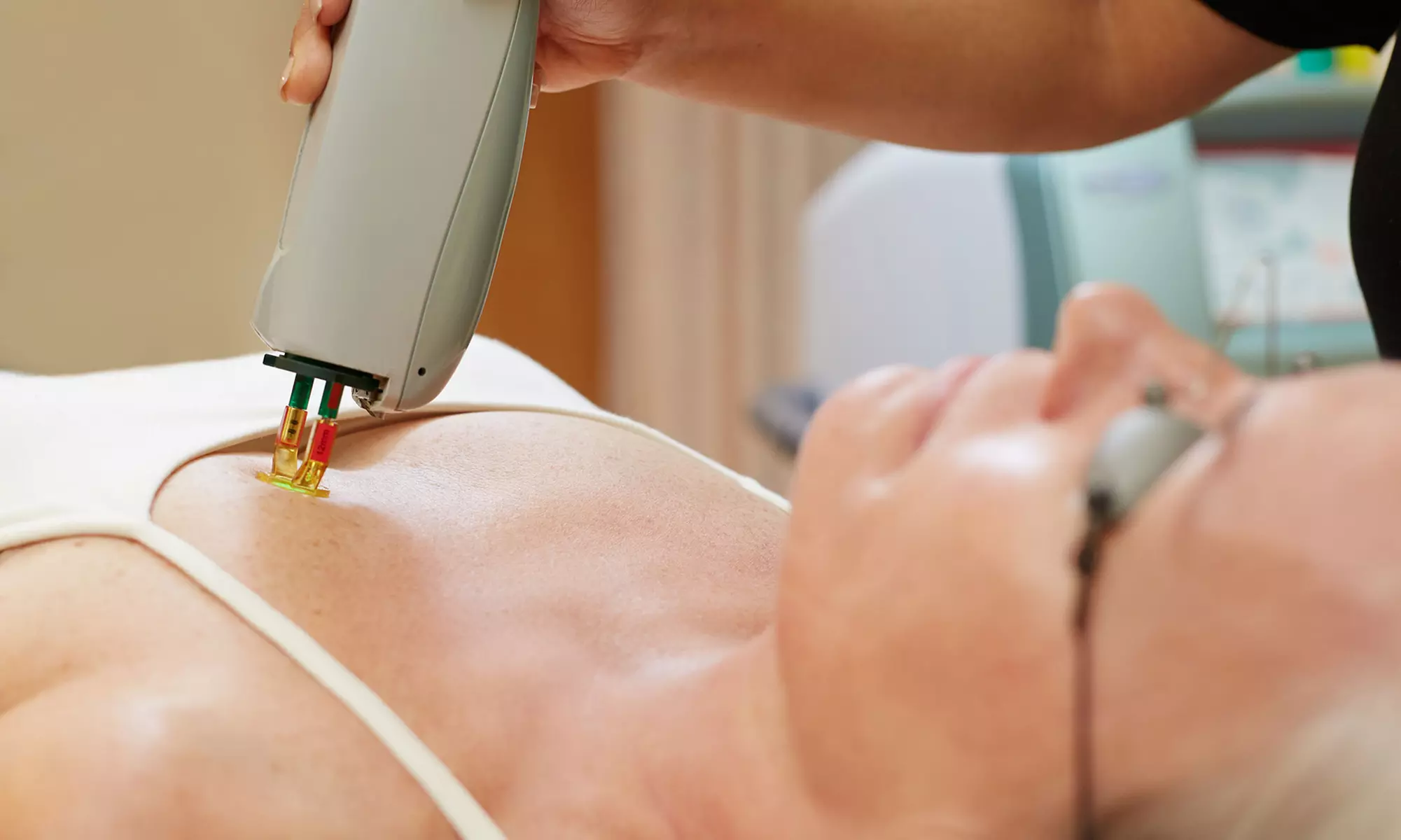 Up to 63% Off on IPL Photo Facial at Gente Laser Center - Primary Image