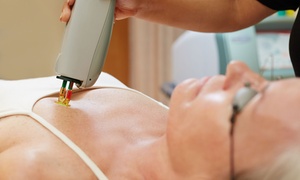 Hamilton Beauty: Laser Hair Removal on One or Two Small or One Medium Area, or on the Full Body at Hamilton Beauty (Up to 75% Off*)