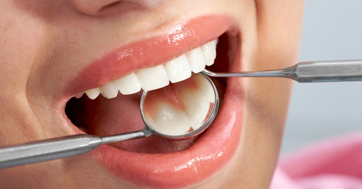 Revisión dental con radiografía y limpieza profesional en Barcelona