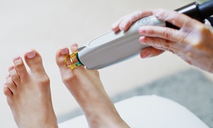 3 or 6 Laser Hair-Removal Treatments or 1 Year of Unlimited Sessions