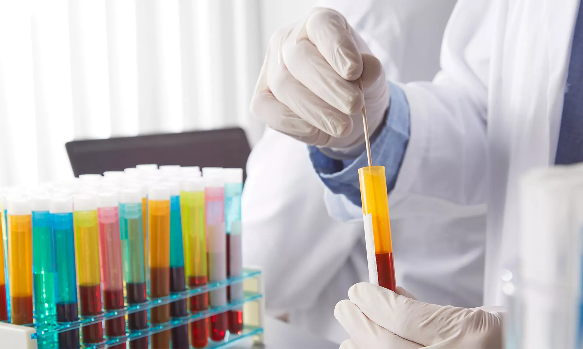 Hormone Testing with Consultations and Lab Work or Personalized Treatment Plan Evaluation at Rejuvenate Medical Group - Primary Image