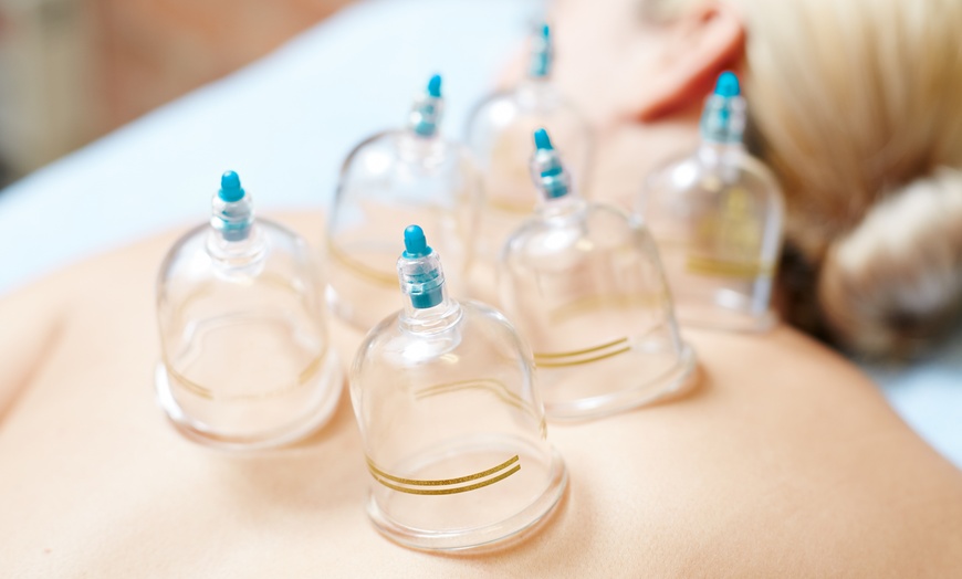 Image 1: Discover the Benefits of 1 or 4 sessions of Vacuum Cupping Therapy 