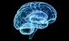 Unlock Your Mind: Neuroplasticity & NLP Courses  from Skill Success (95% Off)