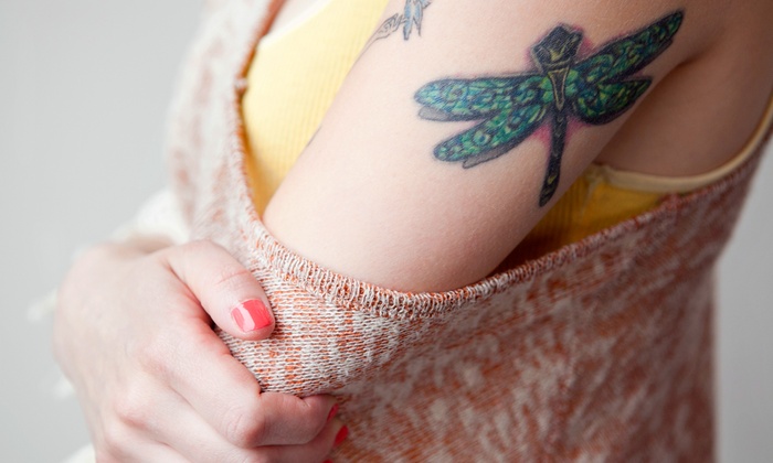 Laser Tattoo Removal - Erase-A-Tat Groupon