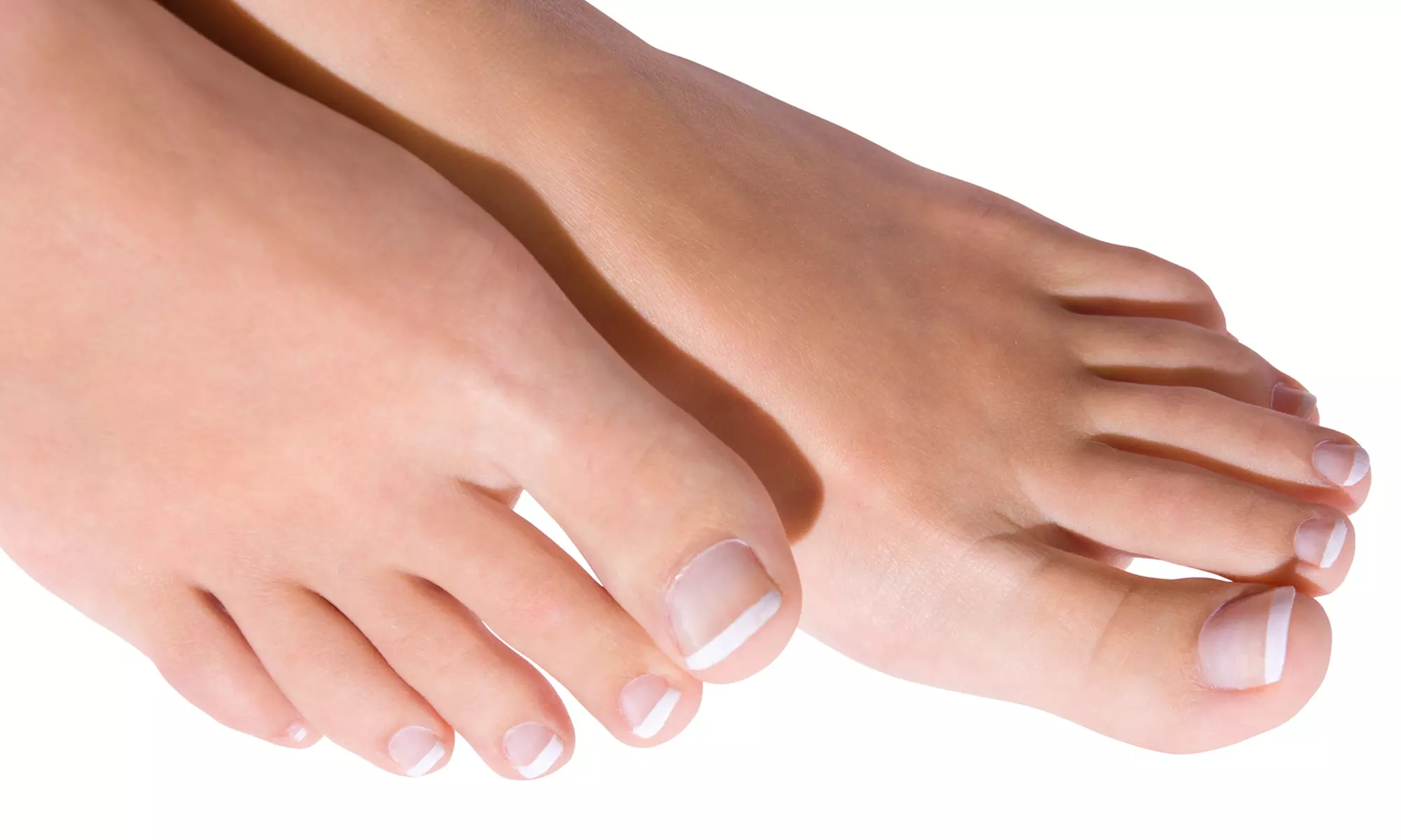 Up to 83% Off on Toe Fungus Treatment at Mt. Tam Foot & Ankle - Primary Image