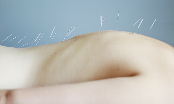 Massage and Acupuncture