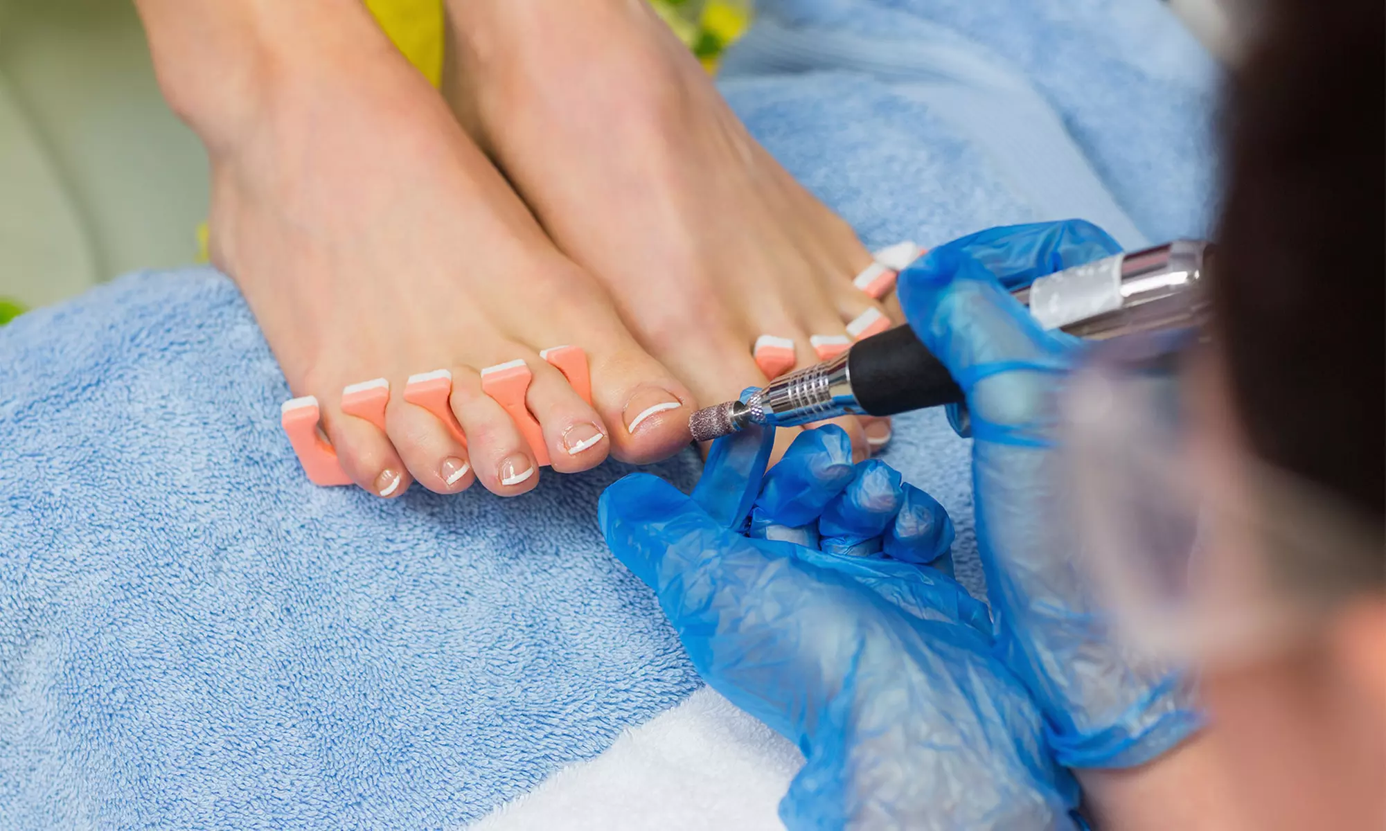 Laser Fungal Nail Treatment