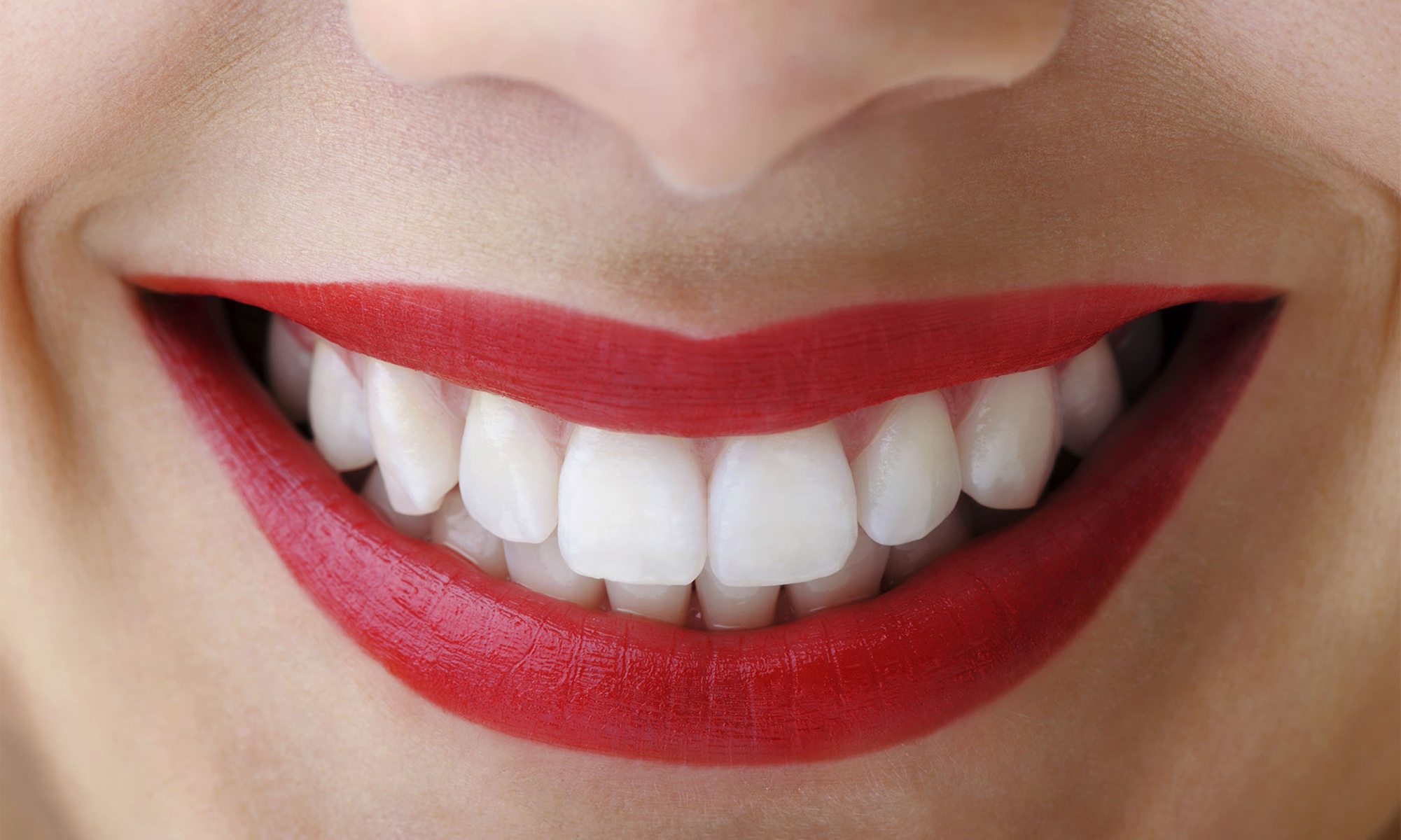 Limpieza dental completa con opción a blanqueamiento y radiografía