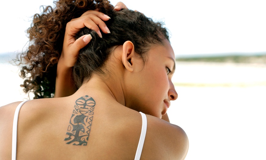 Image 1: Laser Tattoo Removal at Empire Day Spa & Massage