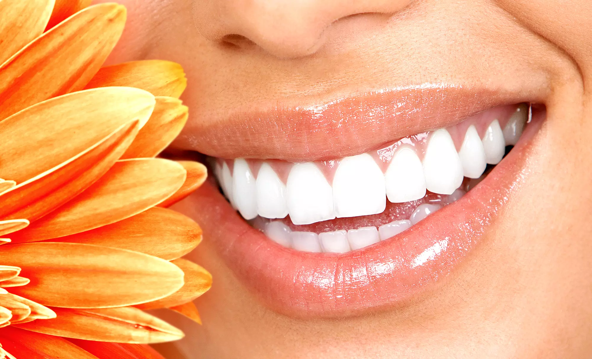 Experience Premium Teeth Whitening DFW's Beauty Package for up to 50% off, enhancing your smile effortlessly.