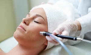 Refresh Your Look with Microdermabrasion Treatments at Health Horizons