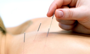 Herbal Clinic: Choice of One (£15) or Two (£19) Holistic Treatments at Herbal Clinic (Up to 65% Off)