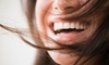 Achieve a whiter smile with Joseph Geleris DDS's in-office treatment, up to 33% off