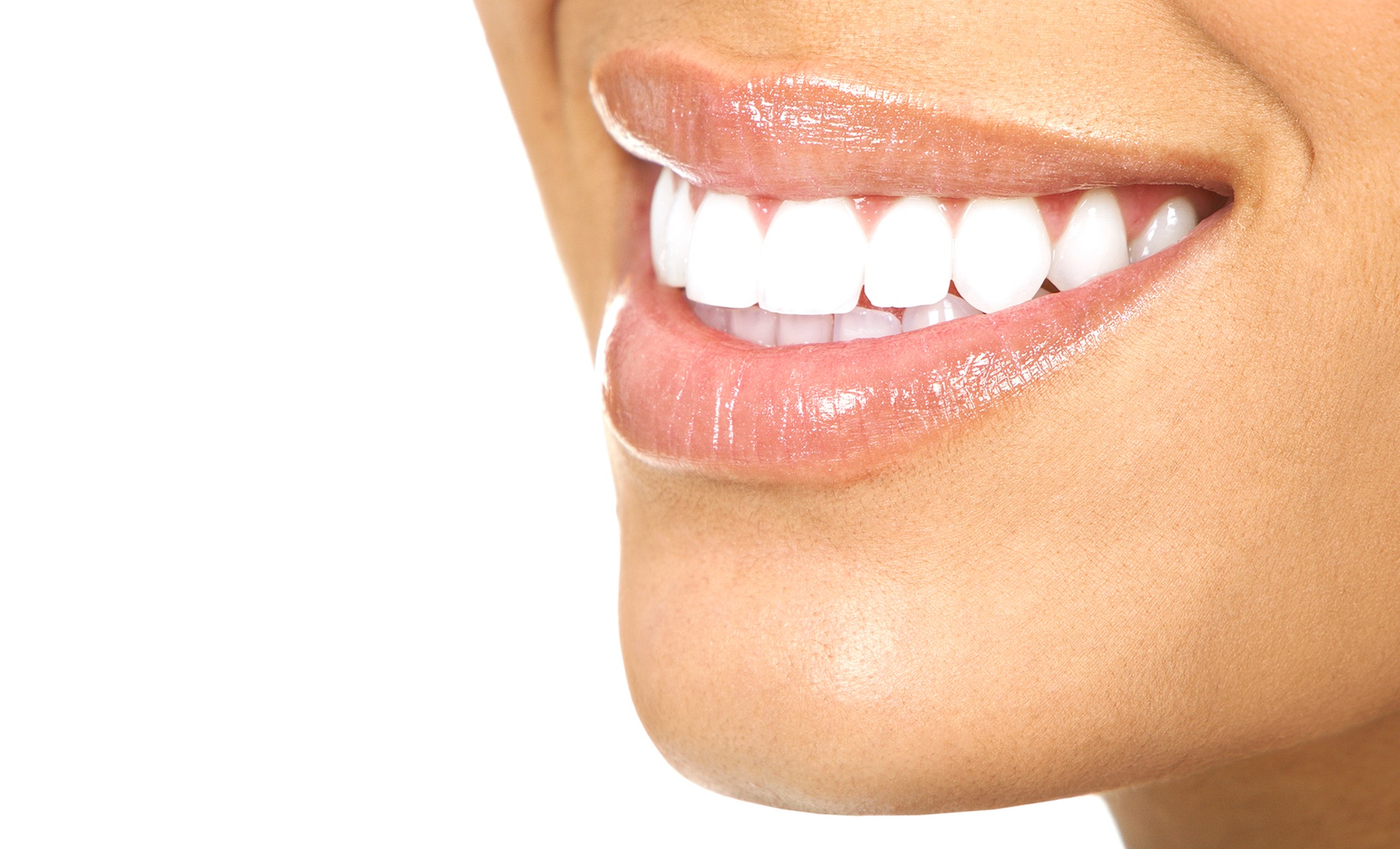 Ortodoncia con Brackets