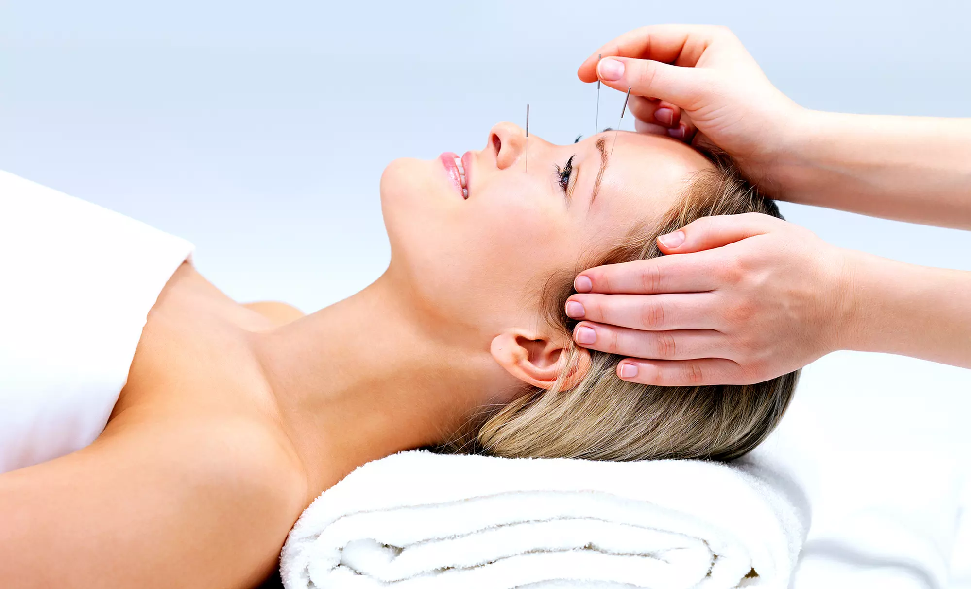 One or Three Acupuncture Treatments at Massage-U-Well (Up to 53% Off) - Primary Image